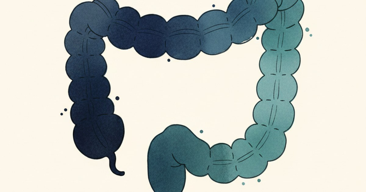 Editorial watercolor of a J-shaped colon with a single teal dot marking a polyp.